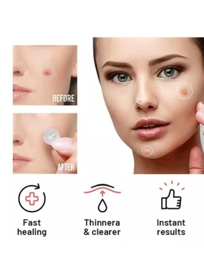 Mighty Patch 36 Pieces Mighty Patch Hydrocolloid Acne Pimple Patch Spot Treatment Beige 5.5inch - Image 3